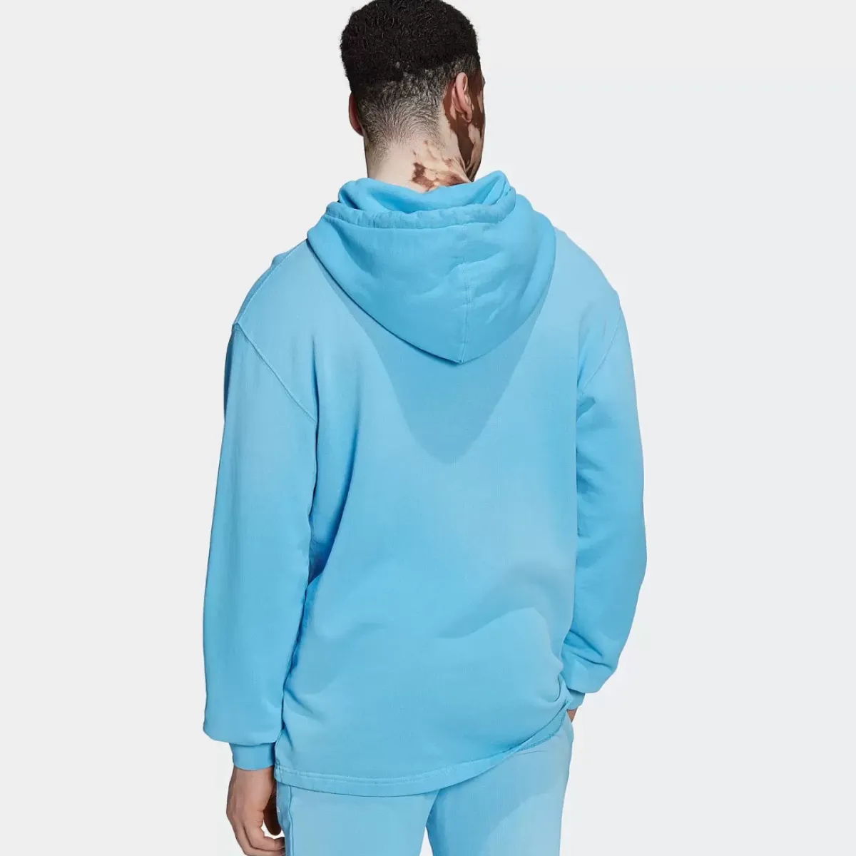 Adidas Originals Hoodies & Crews<Essentials+ Dye Hoodie